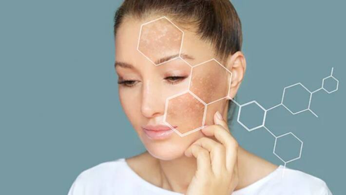facepacks to get rid of wrinkles and black spots facepacks to get rid of wrinkles and black spots