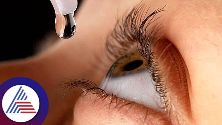 Eye Drops For Red Eyes And Itching Eye Drops For Red Eyes And Itching