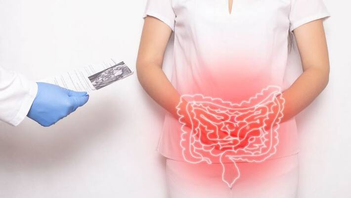 know the symptoms of bowel cancer know the symptoms of bowel cancer