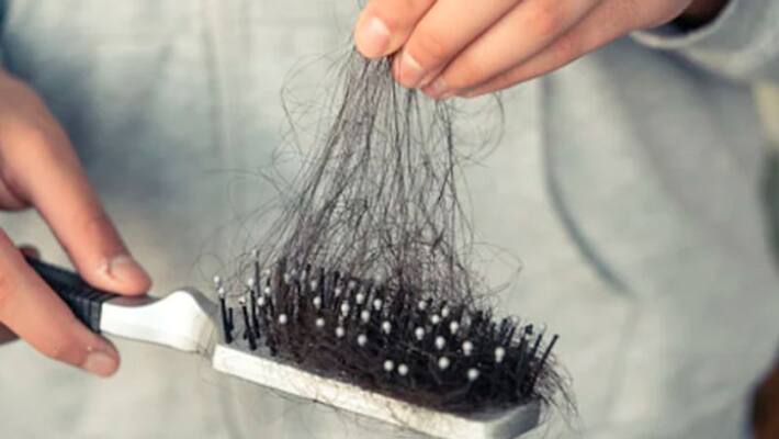 this may be the reason behind sudden hair fall this may be the reason behind sudden hair fall