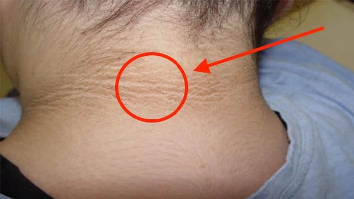 tips to get rid of dark neck tips to get rid of dark neck