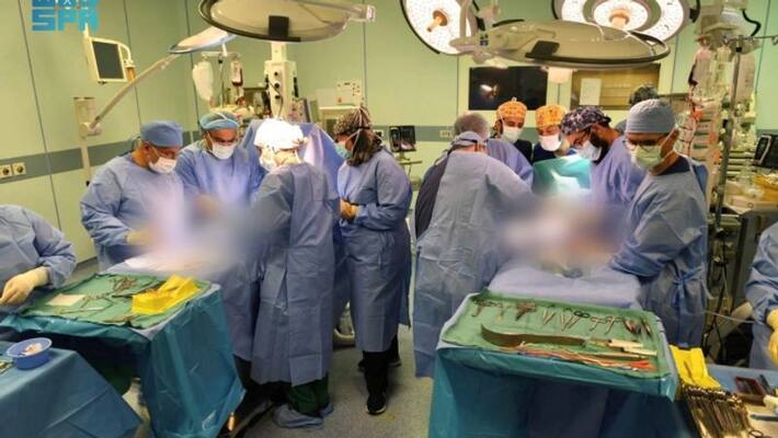 Siamese twins separated after 11 hour longing surgery in six phases in Riyadh Siamese twins separated after 11 hour longing surgery in six phases in Riyadh