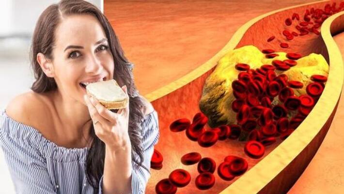 Foods which prevent cholesterol Foods which prevent cholesterol