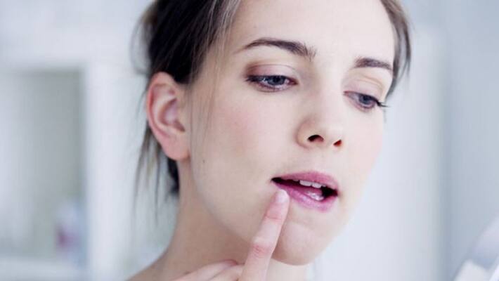 Home Remedies To Beat Chapped Lips In Winter Home Remedies To Beat Chapped Lips In Winter