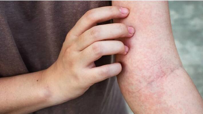 symptoms of liver disease symptoms of liver disease