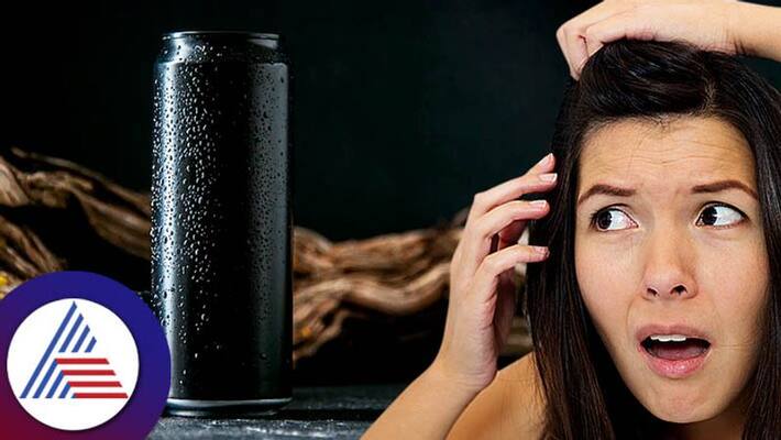 Energy drinks may reason for hair fall in male Energy drinks may reason for hair fall in male