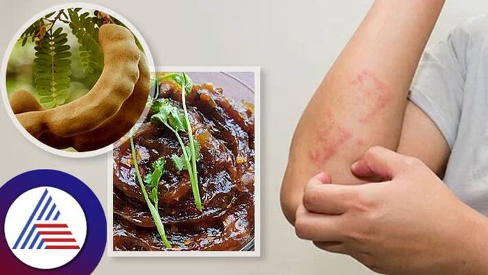 Who Should Not Eat Tamarind Who Should Not Eat Tamarind