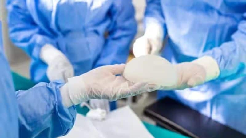 Rare surgery helps 23-year-old woman get rid of gigantic breasts