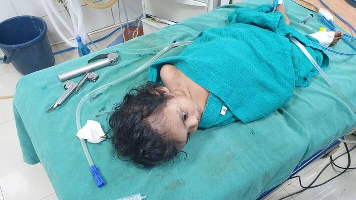 small size of plastic stuck 7 year old boy throat and it was removed by government doctors in coimbatore small size of plastic stuck 7 year old boy throat and it was removed by government doctors in coimbatore