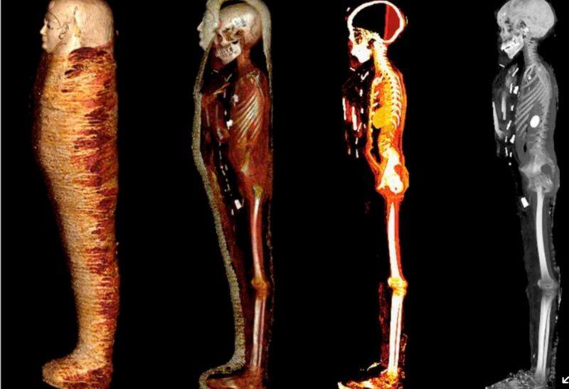 4300 year old mummy was found in Egypt