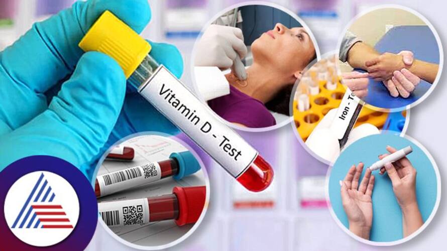 Blood Tests To Get Every Year Blood Tests To Get Every Year