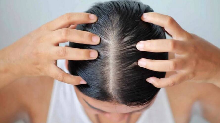 tips to get rid of hair fall tips to get rid of hair fall