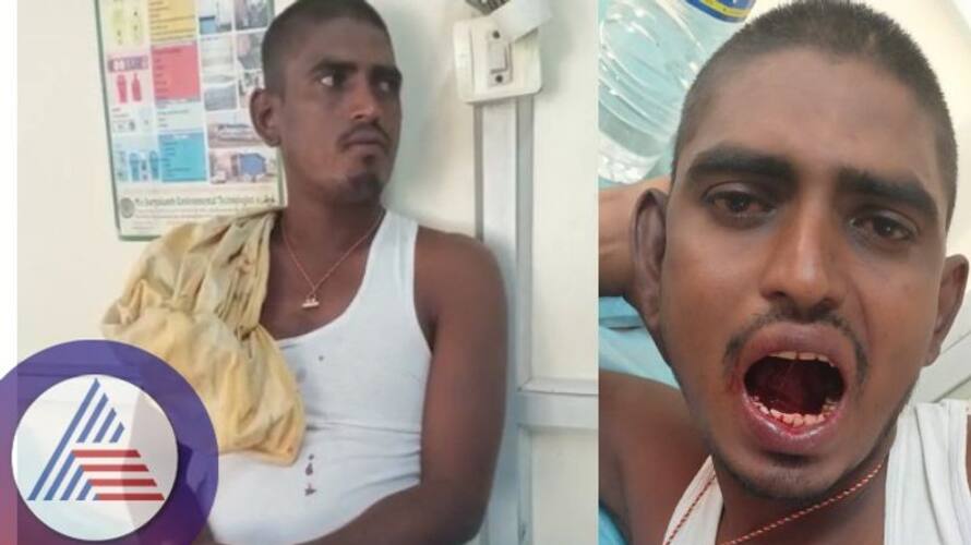 Ballari Shankarappa mutt devotee cut out his tongue as God asked sat Ballari Shankarappa mutt devotee cut out his tongue as God asked sat