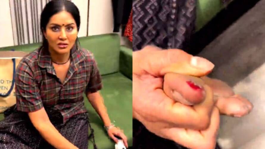 Video Sunny Leone gets hurt, shares video of her bleeding toe on Instagram-WATCH RBA Video Sunny Leone gets hurt, shares video of her bleeding toe on Instagram-WATCH RBA
