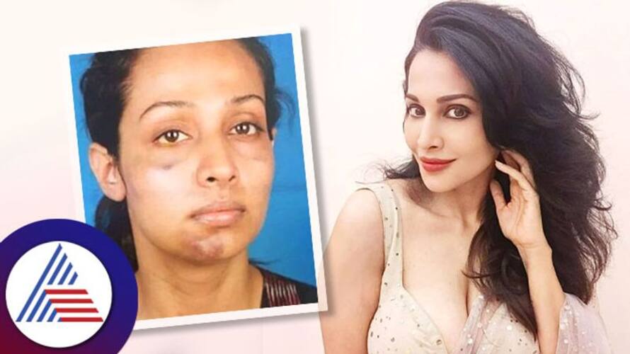 Actress Flora Saini reveals producer brutality says he used to punch my private part Actress Flora Saini reveals producer brutality says he used to punch my private part
