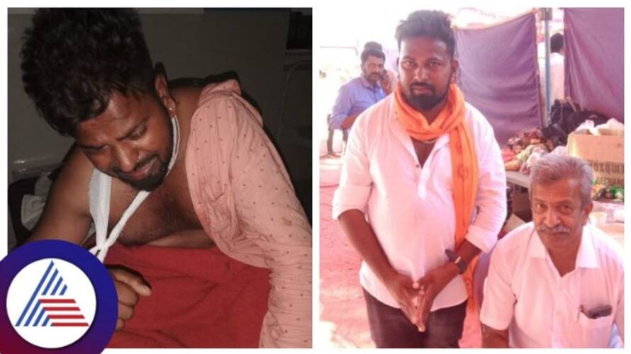 Congress workers break a youth hand for joining BJP in chikkamagaluru gow Congress workers break a youth hand for joining BJP in chikkamagaluru gow