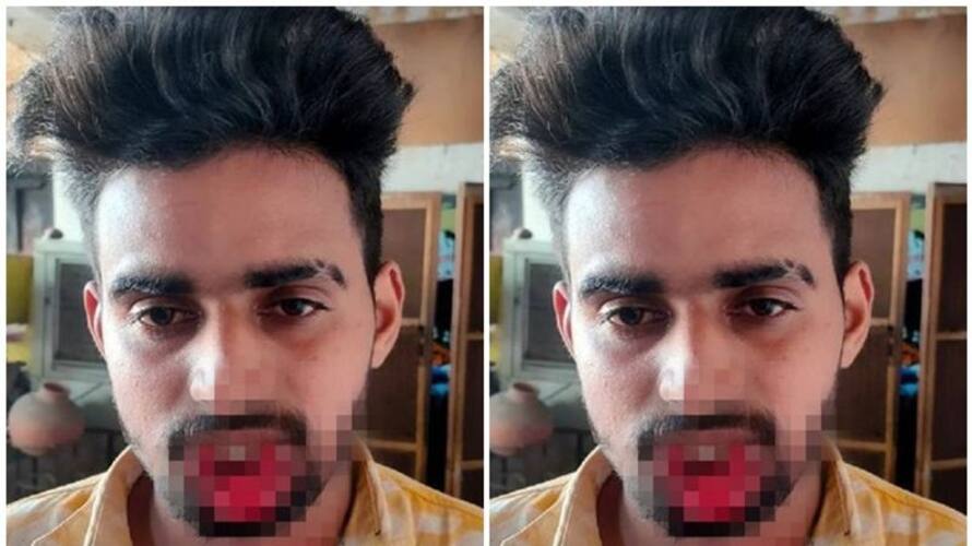 Uttar Pradesh girl bites off mans lips as he tries to kiss her forcefully Uttar Pradesh girl bites off mans lips as he tries to kiss her forcefully