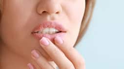 tips to get rid of chapped lips azn