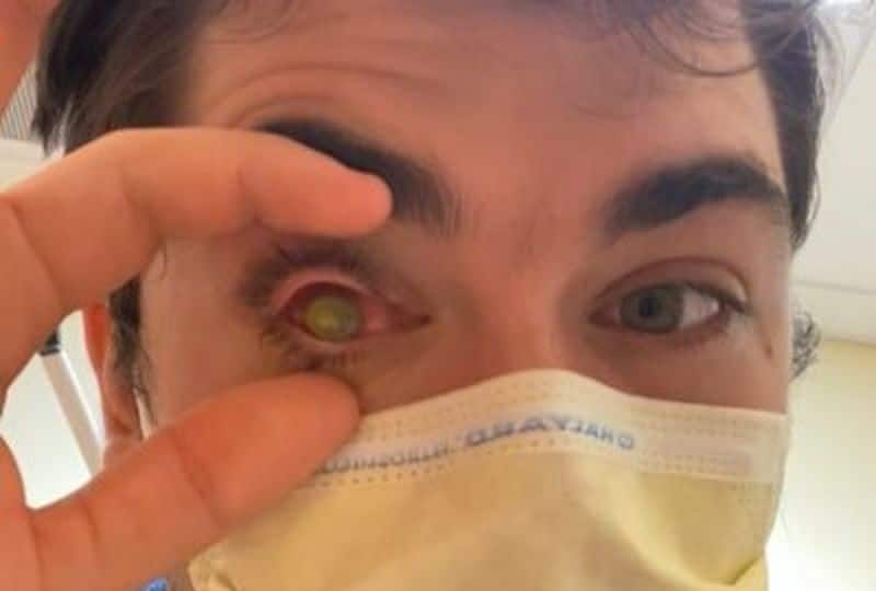 Man Fell Asleep With Contact Lenses On, Flesh-Eating Parasites Eat His Eye