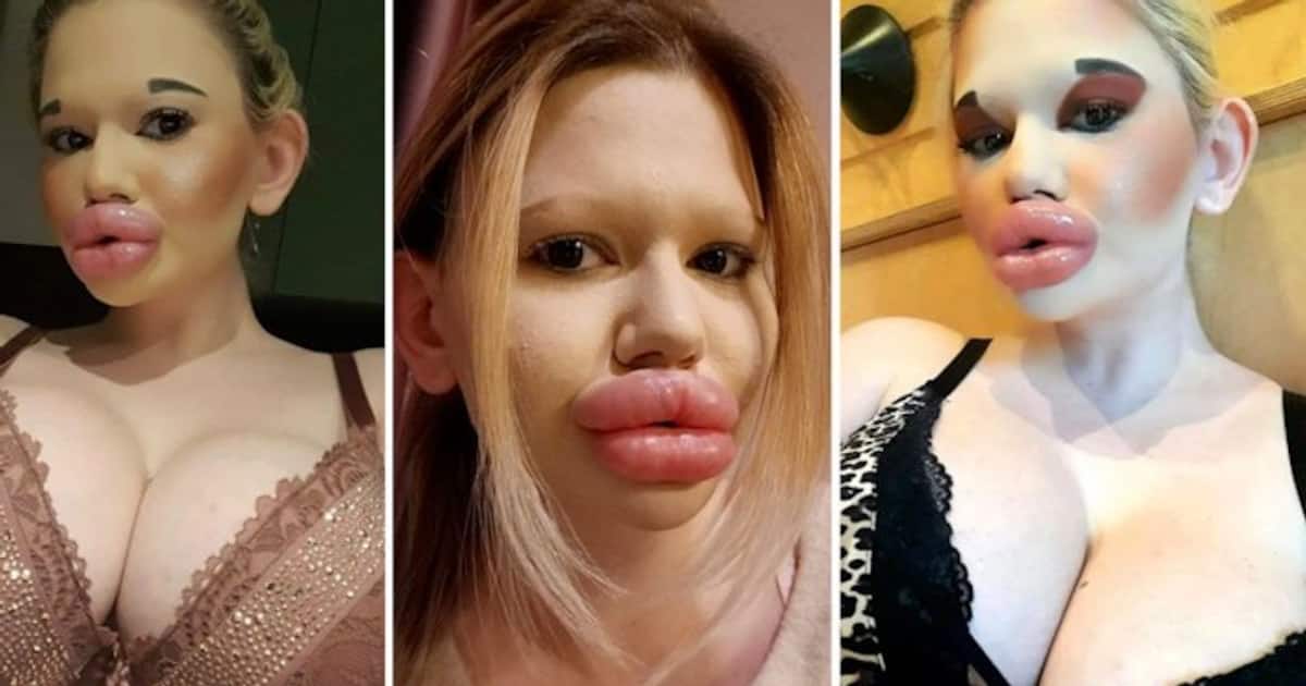 Bulgarian Andrea Ivanova Who Has The World's Biggest Lips Wants