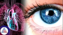 5 symptoms of heart attack appear in your eyes