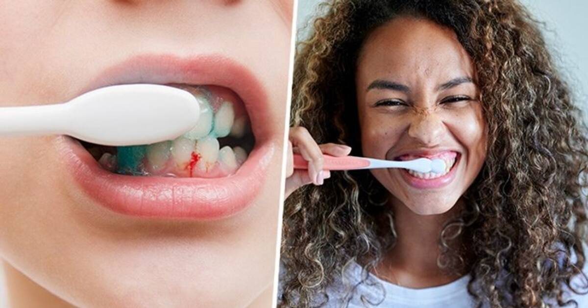 Three crucial oral hygiene habits to avoid bleeding gums and cavities