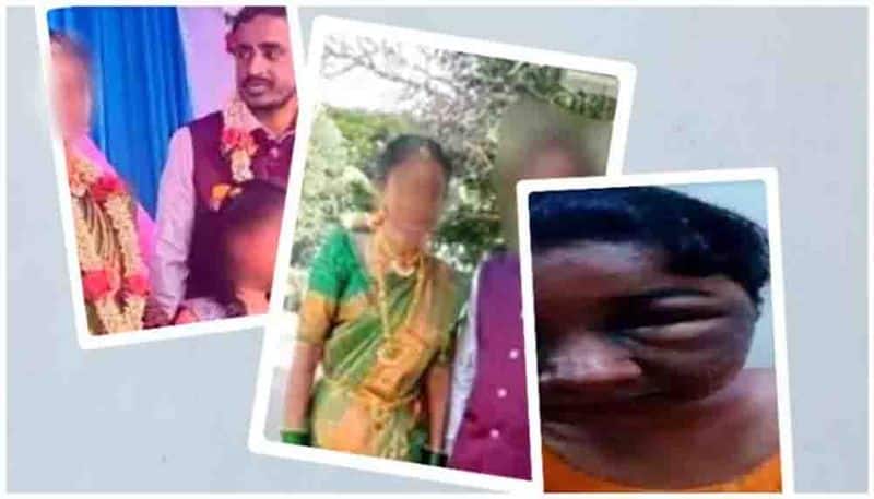 Karnataka woman face disfigured during makeup, groom calls off wedding