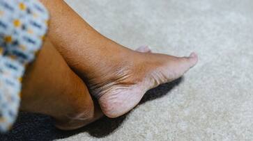 6 tips for healthy feet