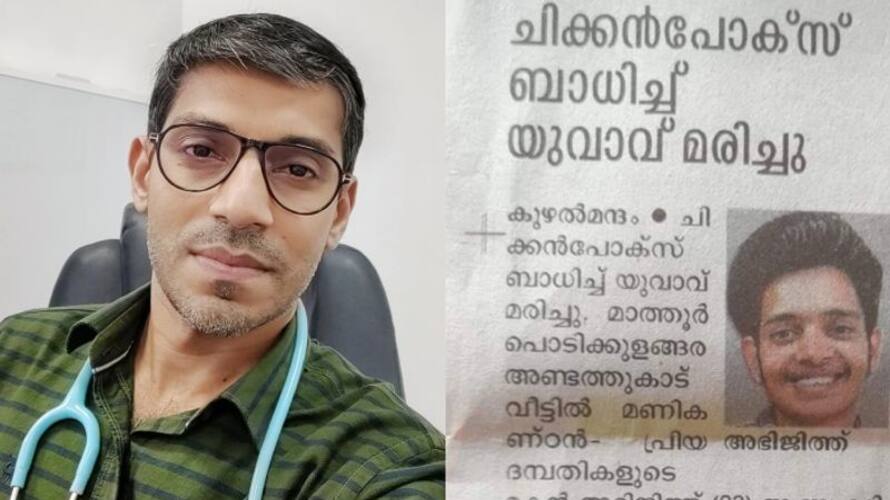 doctor writes about chickenpox how leads to death hyp doctor writes about chickenpox how leads to death hyp