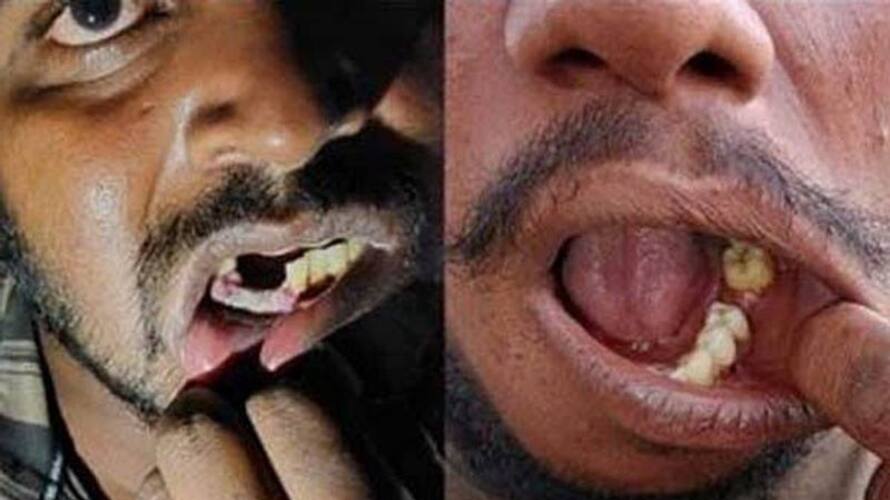 IPS Officer Accused Of Breaking Teeth, Crushed Testicles Of Men In Custody, Suspended in Tamil Nadu - bsb IPS Officer Accused Of Breaking Teeth, Crushed Testicles Of Men In Custody, Suspended in Tamil Nadu - bsb