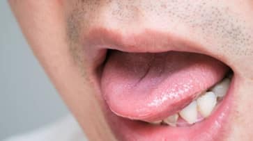 wife bites husbands tongue in andhra pradeshs kurnool dist kms wife bites husbands tongue in andhra pradeshs kurnool dist kms