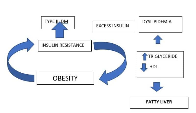 How can obesity cause NAFLD? Can an untreated NAFLD lead to Liver cancer? RBA