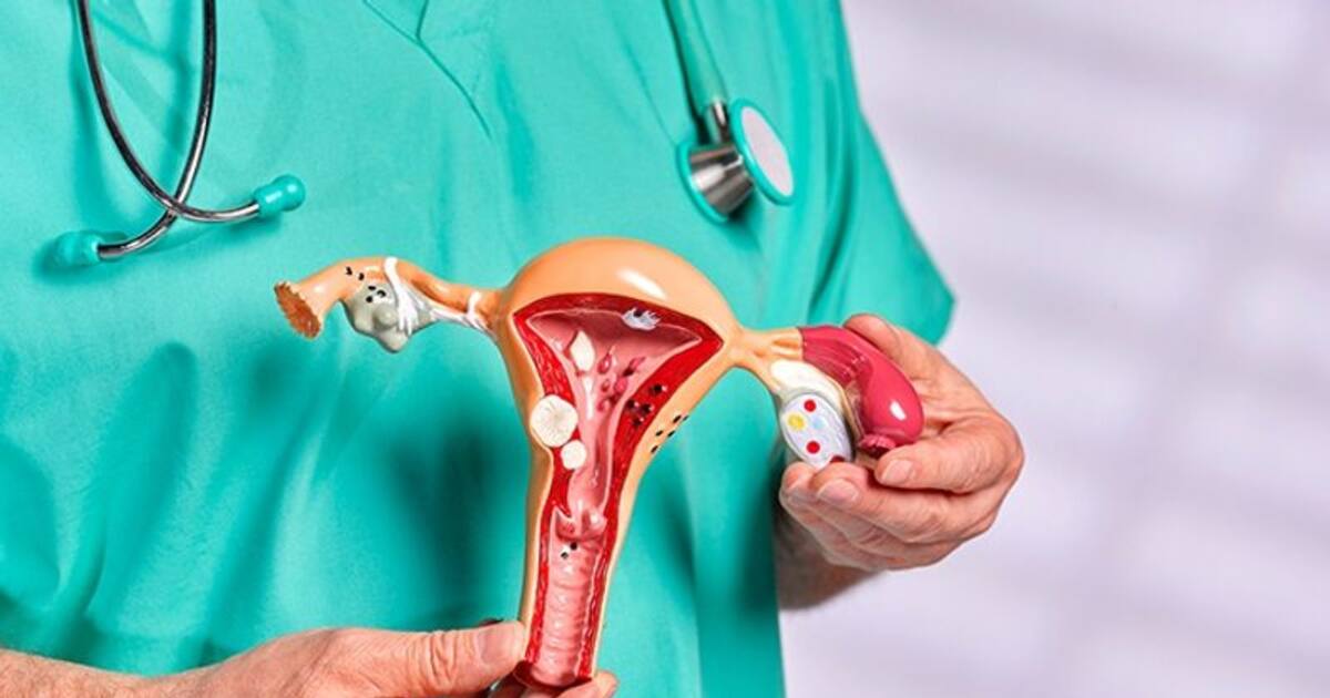 From leafy greens vegetables to Probiotics6, food items to have