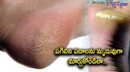 home remedies for cracked feet-know the details