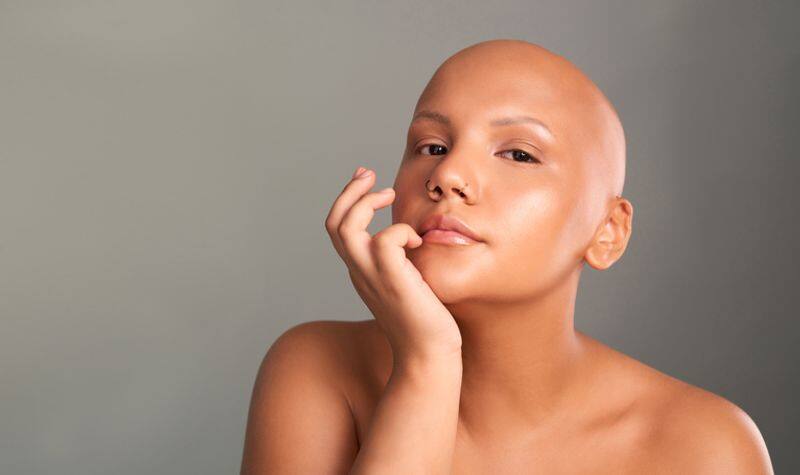 Hair loss and thinning: 9 types of alopecia you should be aware of (ARB)