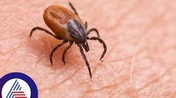Powassan virus symptoms and how to control it 