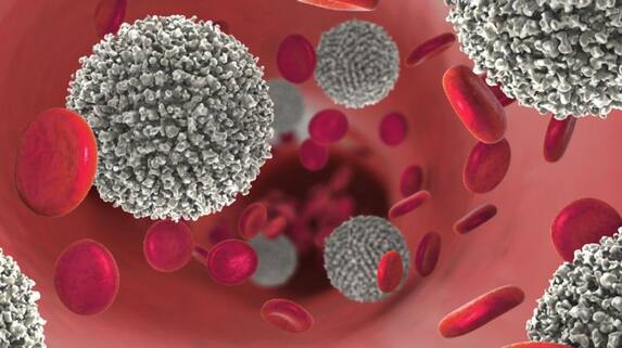 early warning signs of blood cancer rsl early warning signs of blood cancer rsl