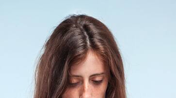 Constant headaches, hair loss problem? Then eat these foods regularly! Rya Constant headaches, hair loss problem? Then eat these foods regularly! Rya
