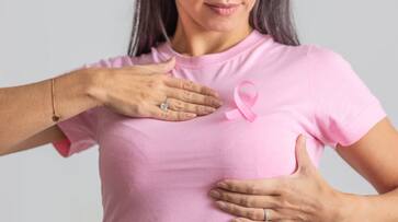 Triple Negative Breast Cancer: Characteristics, treatment options, and emerging therapies RBA Triple Negative Breast Cancer: Characteristics, treatment options, and emerging therapies RBA