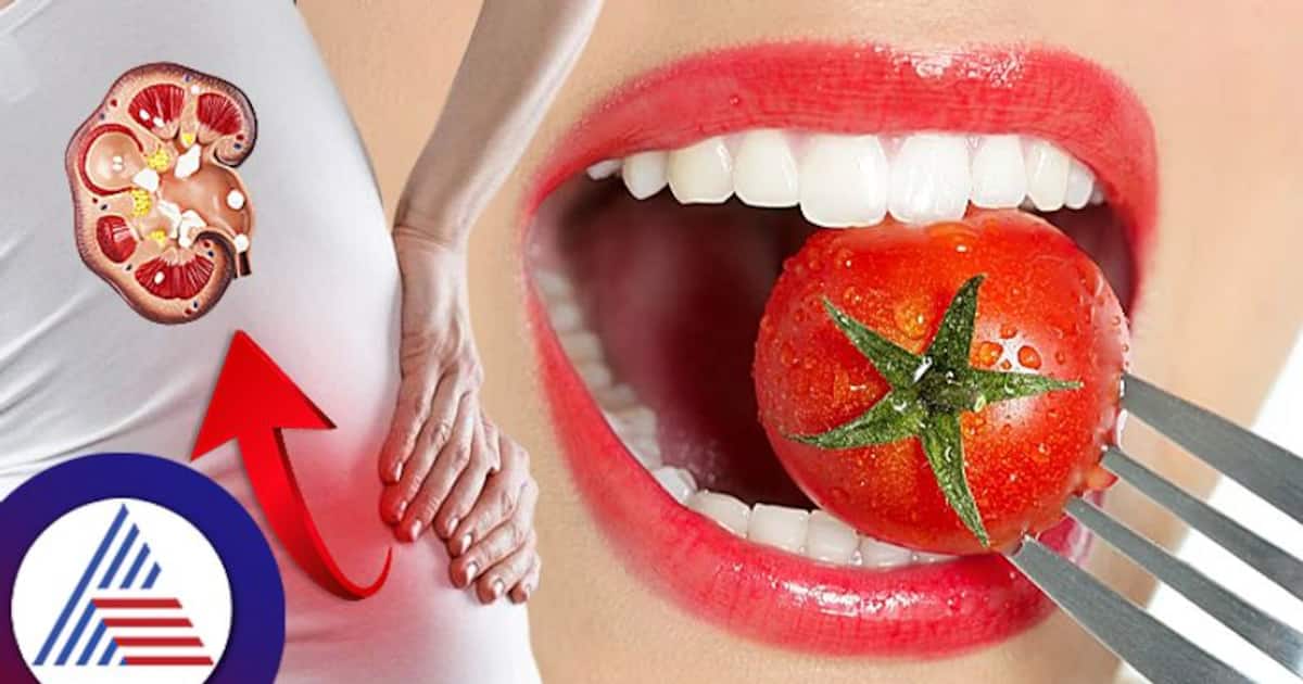 Health Tips ಟೋಮ್ಯಾಟೋ ತಿನ್ನೋದ್ರಿಂದ ಕಿಡ್ನಿ ಸ್ಟೋನ್ ಹೆಚ್ಚುತ್ತಾ?
