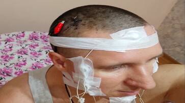 Russian Man Performed himself a brain surgery with driller almost died Russian Man Performed himself a brain surgery with driller almost died