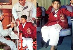 Riyaz lost his hands and a leg while saving the life of a girl and received gallantry awards iwh