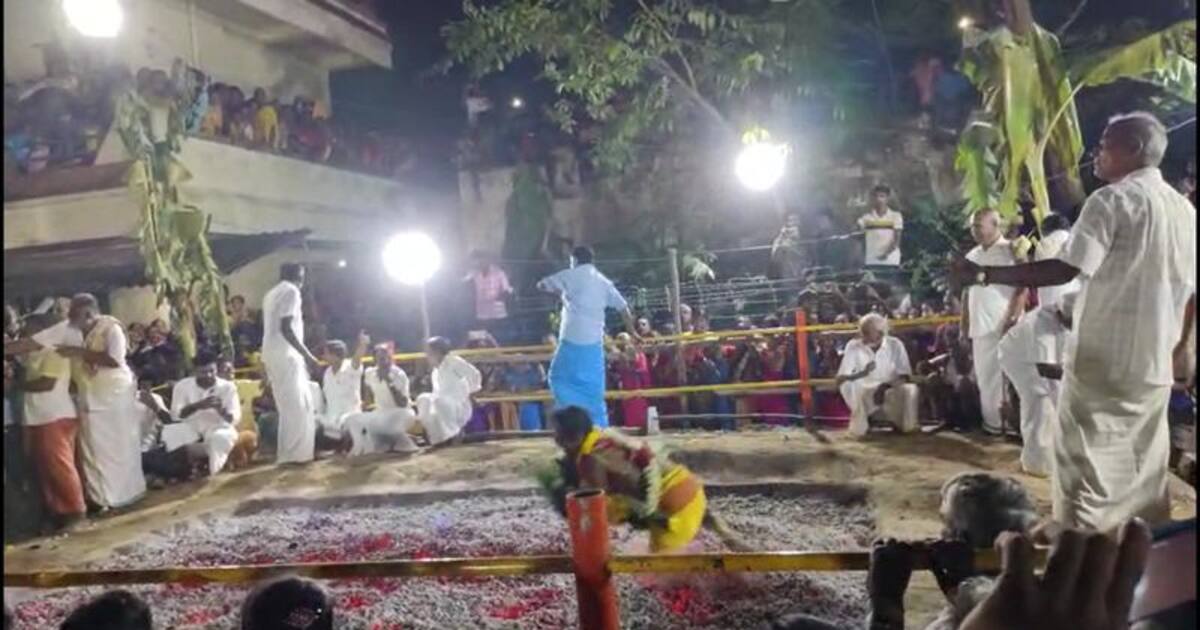 தந்தையின் அஜாக்கிரதையால் தீக்குளியில் விழுந்த 1 வயது குழந்தை கவலைக்கிடம்; அரசு நடவடிக்கை எடுக்க கோரிக்கை