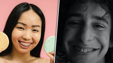 Age to professional advice: 6 factors to keep in mind before getting teeth braces LMA EAI Age to professional advice: 6 factors to keep in mind before getting teeth braces LMA EAI