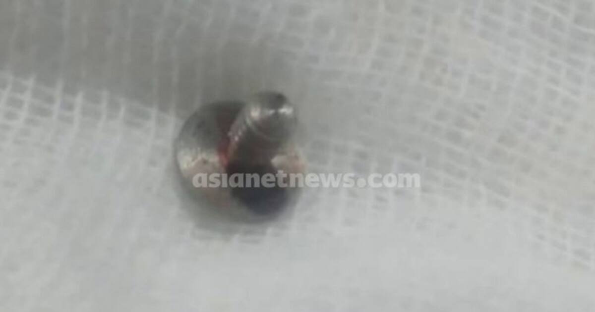 Kerala Surgical clip left in teenager's stomach after surgery; Family