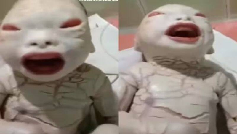 World viral women gave birth child with harlequin ichthyosis disorder people says alien kxa 