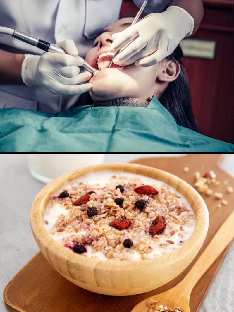 7-best-foods-to-have-after-wisdom-teeth-removal