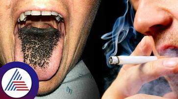 Cigarette Smokers Should Be Careful If You Get This Disease Your Tongue Will Turn Green roo Cigarette Smokers Should Be Careful If You Get This Disease Your Tongue Will Turn Green roo