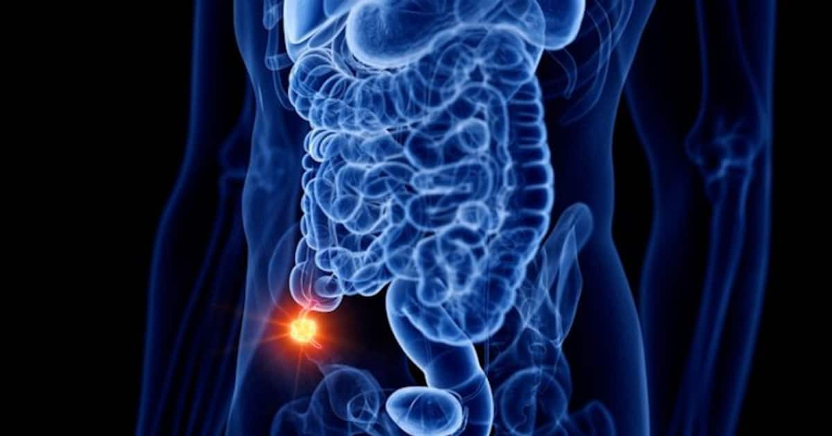 appendix-cancers-cancerindex