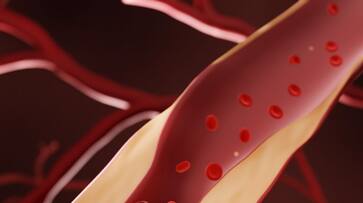 these four things can raise bad cholesterol these four things can raise bad cholesterol